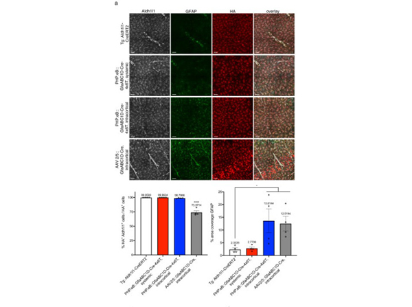 Immunofluorescence using GFAP