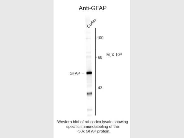 Western Blot of Anti-Glial Fibrillary Acidic Protein (GFAP) (Chicken) Antibody - 200-901-D60