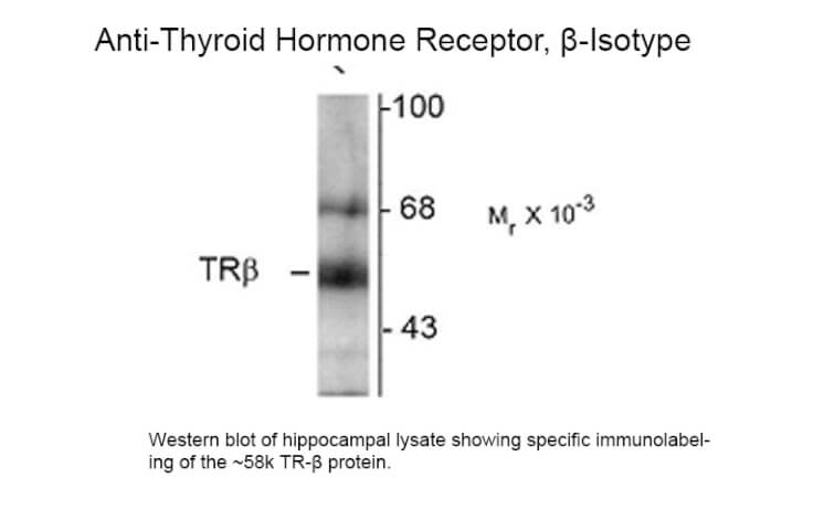 Western blot of Anti-Thyroid Hormone Receptor beta (Mouse) Antibody - 209-301-A96
