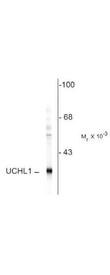 Western Blot - Ubiquitin Hydrolase (UCHL1)