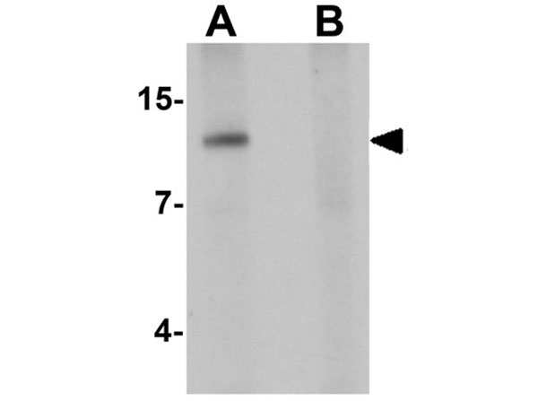 Western blot of SDHAF2