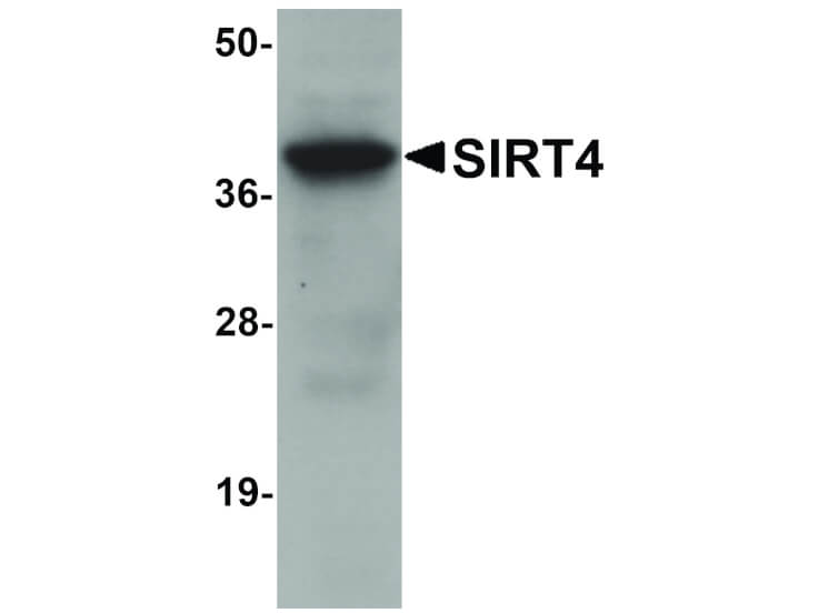 Western Blot of SIRT4 Antibody