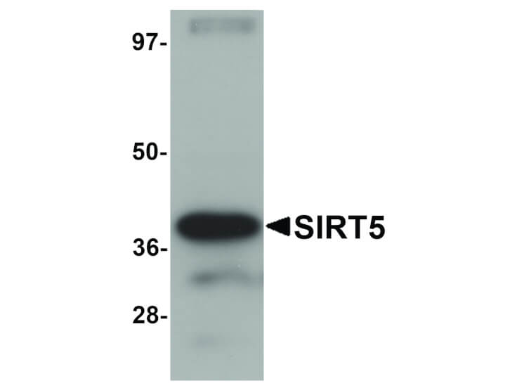 Western Blot of SIRT5 Antibody