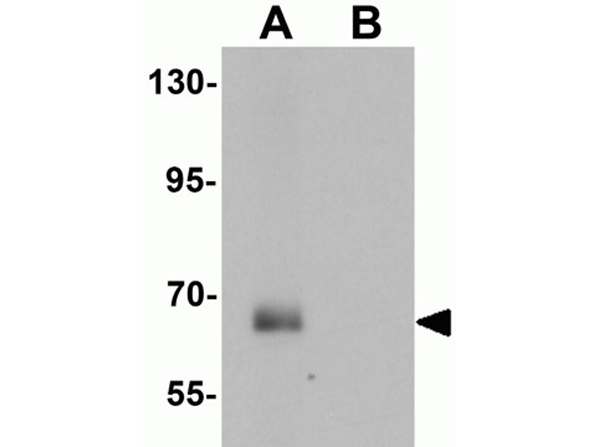 Western blot analysis of SPATA18