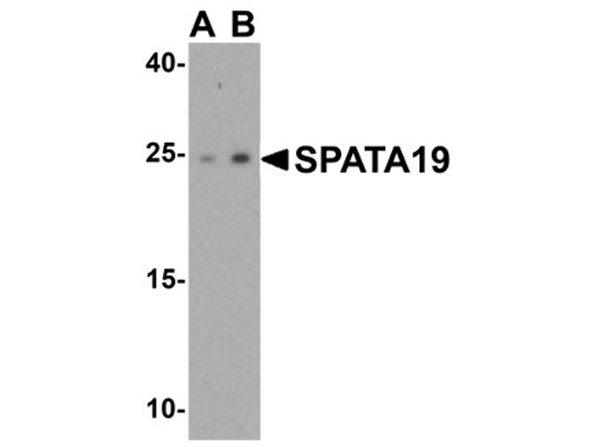 Western blot analysis of SPATA19