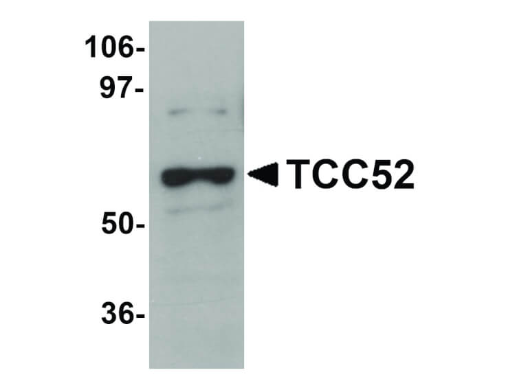 Western Blot of TCC52 Antibody