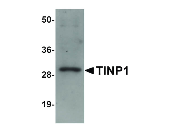 Western Blot of TINP1 Antibody