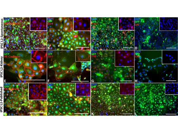 Immunohistochemistry using Transthyretin