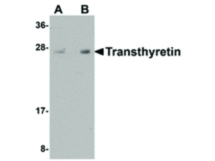 Western Blot of Transthyretin Antibody