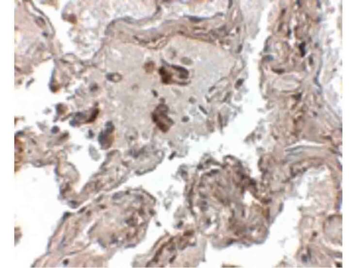 Immunohistochemistry of Transthyretin Antibody