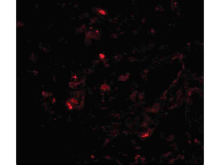 Immunofluorescence of Transthyretin Antibody