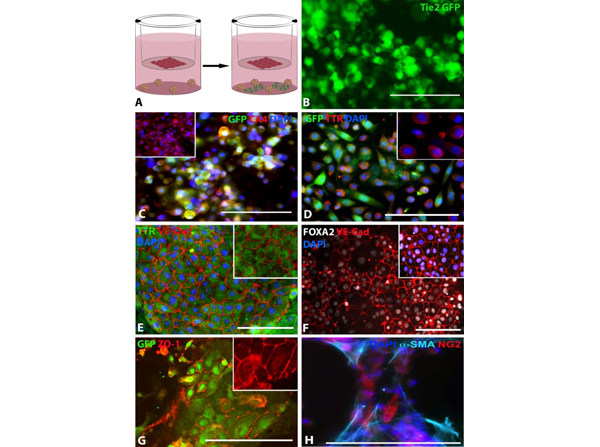 Immunohistochemistry using Transthyretin
