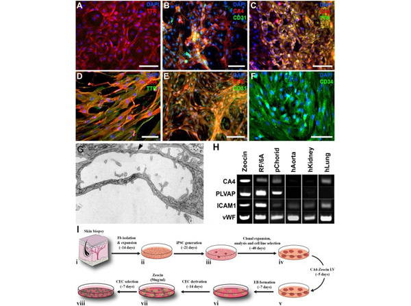 Immunohistochemistry using Transthyretin