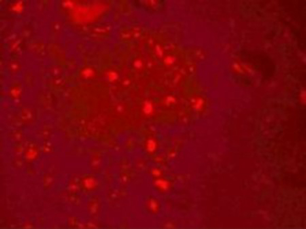 Immunofluorescence of ZGPAT