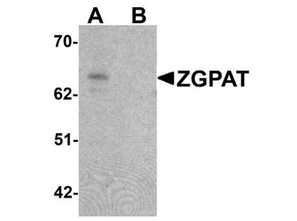 Western blot analysis of ZGPAT