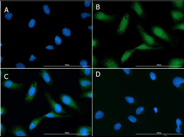 Immunofluorescence of Chicken Anti-C9orf72 Antibody