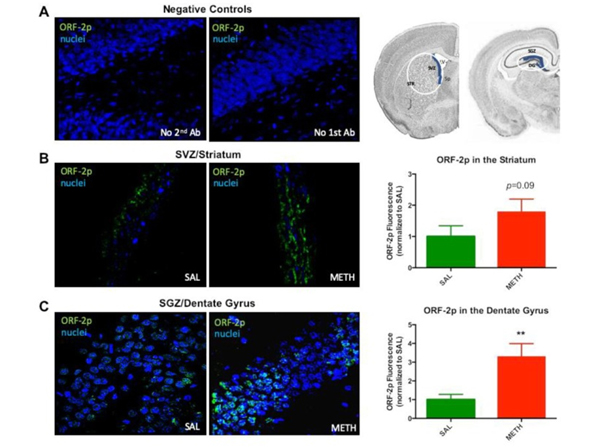 Immunohistochemistry using L1/ORF2