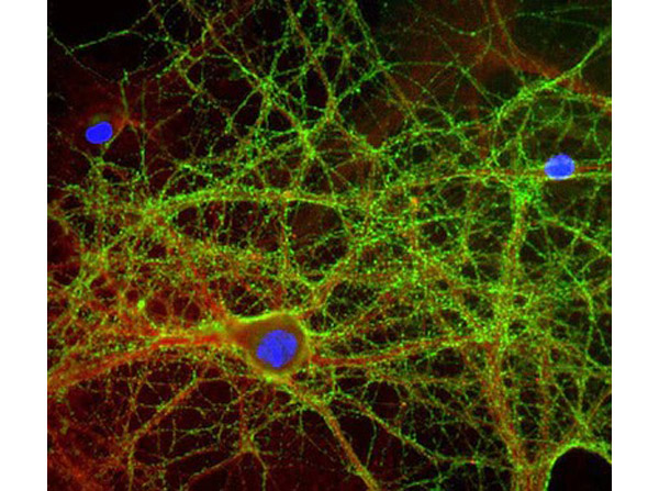 Immunofluorescence of Anti-GAP43 antibody.