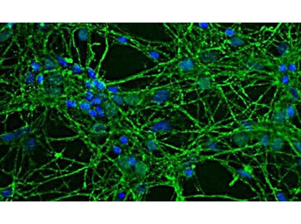 Immunofluorescence of Anti-GAP43 antibody.