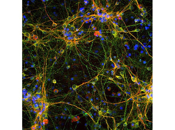 Immunostaining of Anti-TAU antibody