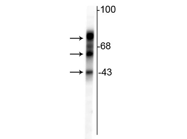 Western Blot of Anti-TAU antibody