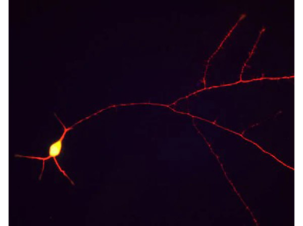 Immunostaining of Anti-TAU antibody