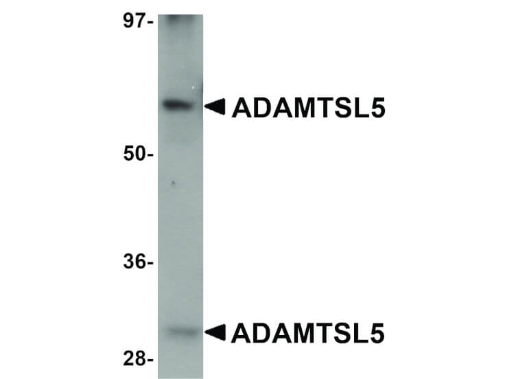 Western Blot of ADAMTSL5 Antibody