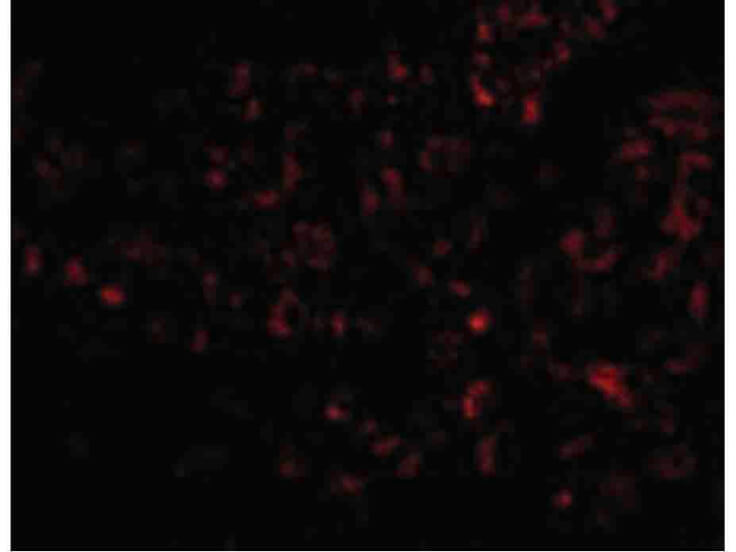 Immunofluorescence of Albumin Antibody