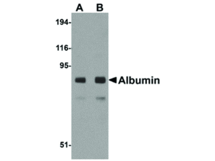 Western Blot of Albumin Antibody