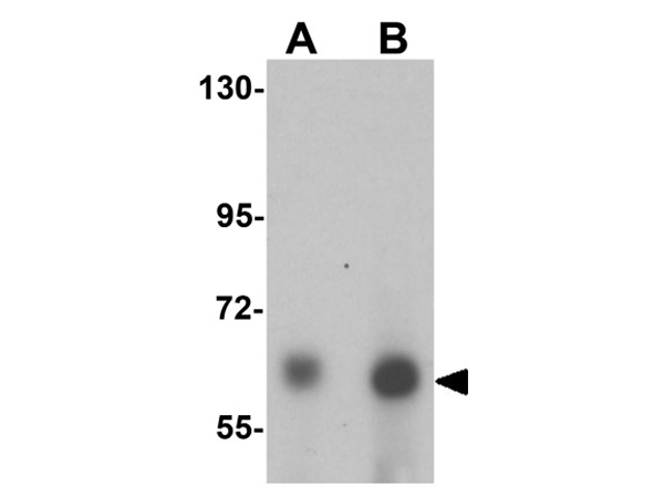Western blot analysis of ANKLE1