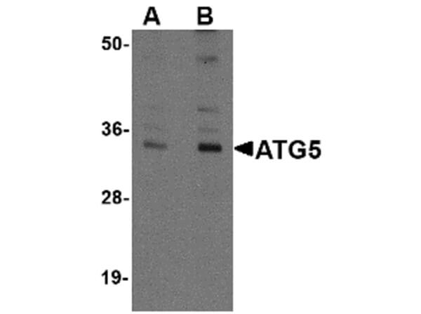 Western Blot of Chicken Anti-ATG5 Antibody.