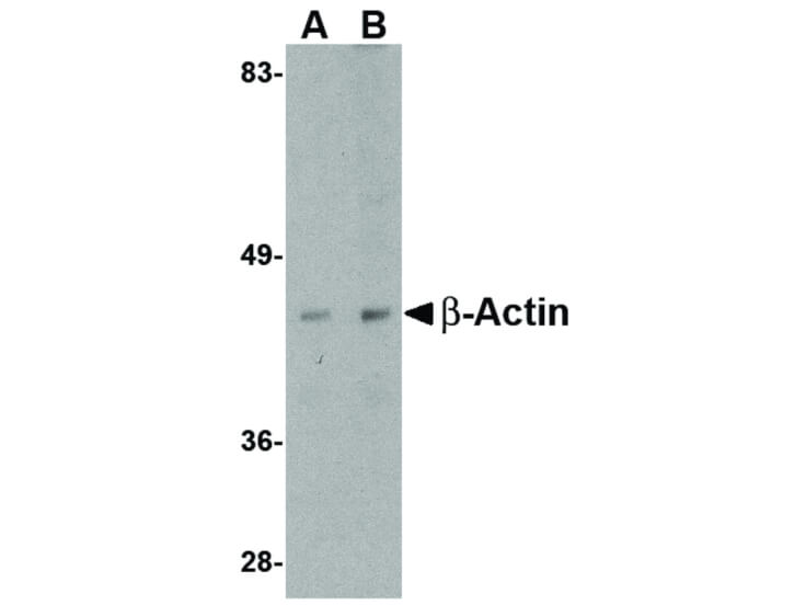 Western Blot of Beta-actin Antibody