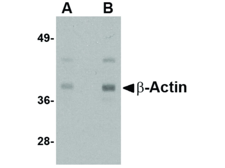 Western Blot of Beta-actin Antibody