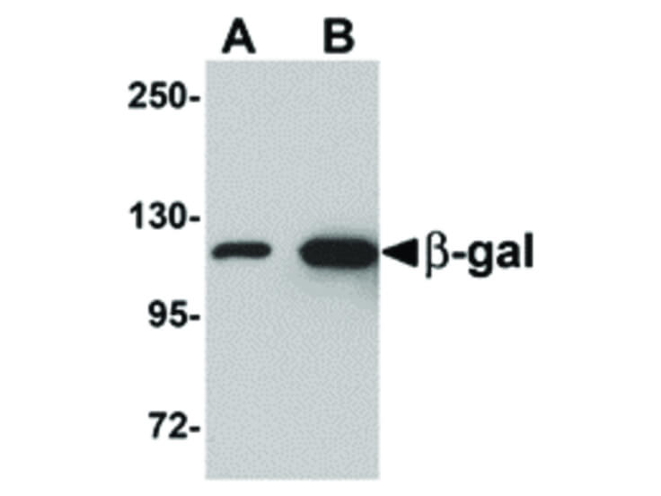 Western Blot of beta-Galactosidase Antibody