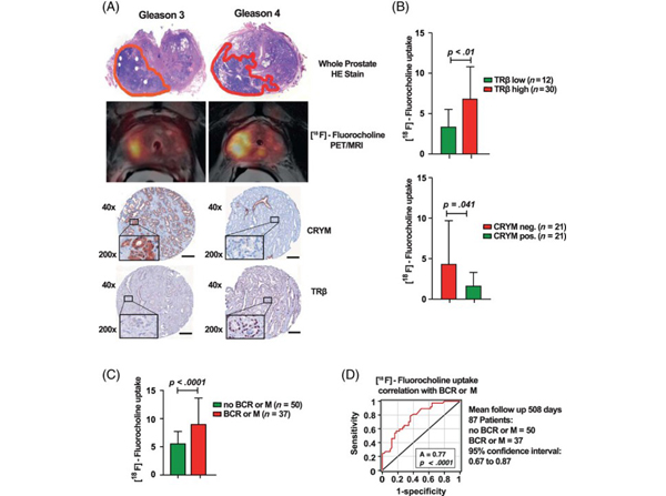 Immunohistochemistry using THRb