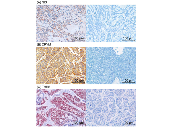 Immunohistochemistry using THRb