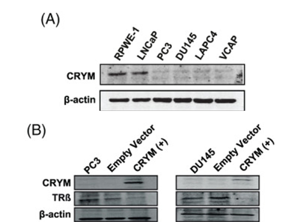 Western Blot using THRb