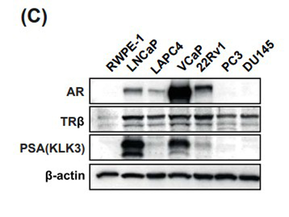 Western Blot using THRb