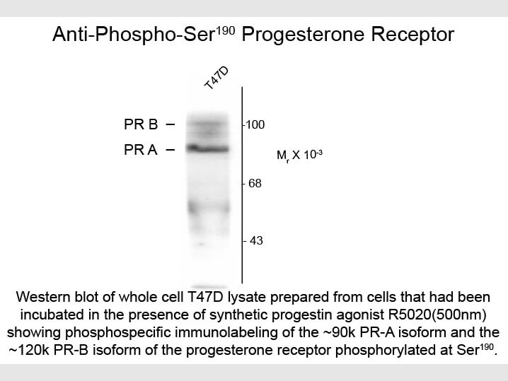 Western blot of Anti-Progesterone Receptor pS190 (Mouse) Antibody - 209-301-E16
