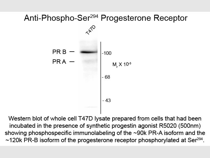 Western blot of Anti-Progesterone Receptor pS294 (Mouse) Antibody - 209-301-E17