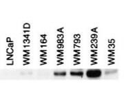 Western Blot - BIN-1 Antibody
