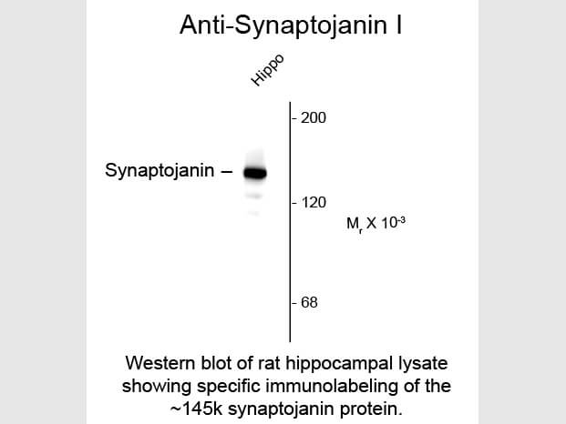 Western blot of Anti-Synaptojanin 1 (Mouse) Antibody - 212-301-E35