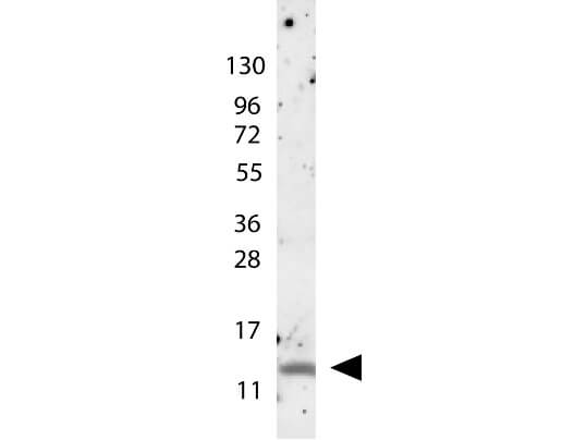 Anti-MIP-1ß Antibody - Western Blot