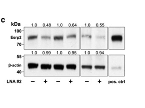 Western Blot using Esrp2