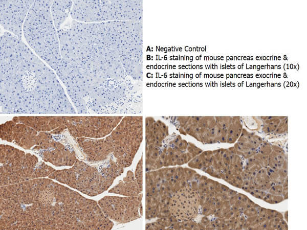 Anti-Mouse IL-6 Antibody-IHC