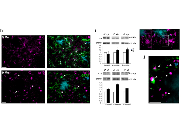 Immunofluorescence using IL beta