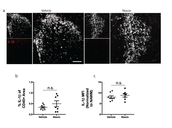 Immunofluorescence using IL beta