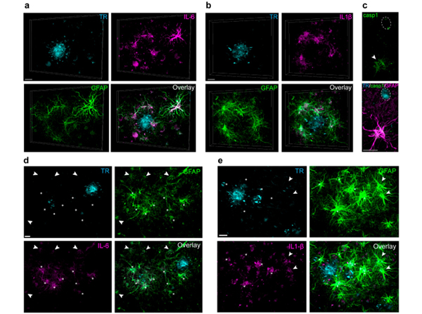 Immunofluorescence using IL beta