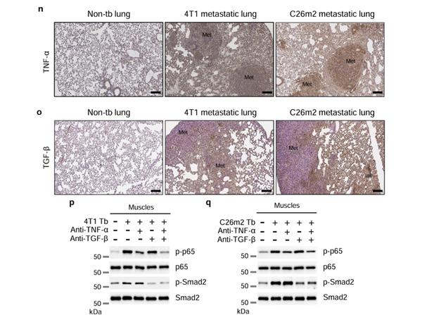 Immunohistochemistry using TNFa