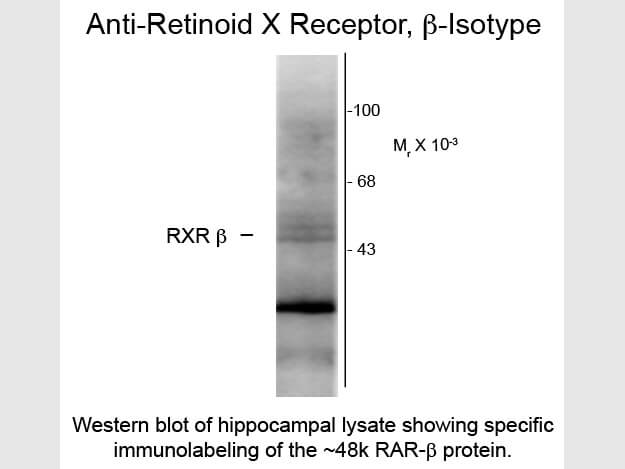 Western blot of Anti-Retinoid X Receptor beta (Mouse) Antibody - 200-301-E27